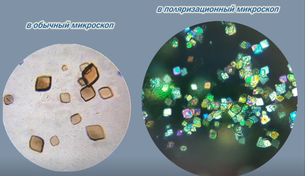 В Ивановской областной клинической больнице установили поляризационный микроскоп