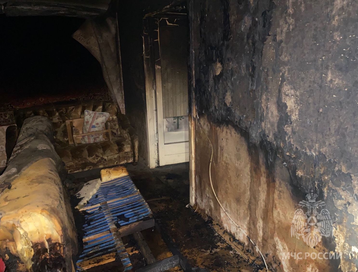 При пожаре в многоквартирном доме в Шуе мужчина получил ожоги 